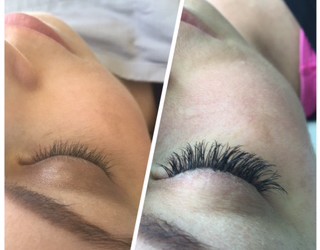 Five Questions about EyeLash Extensions